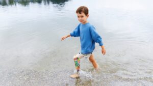 Toni trägt den Maverick junior Prothesenfuß aus Glasfaser.