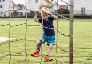 Kind mit Beinprothese klettert auf dem Spielplatz